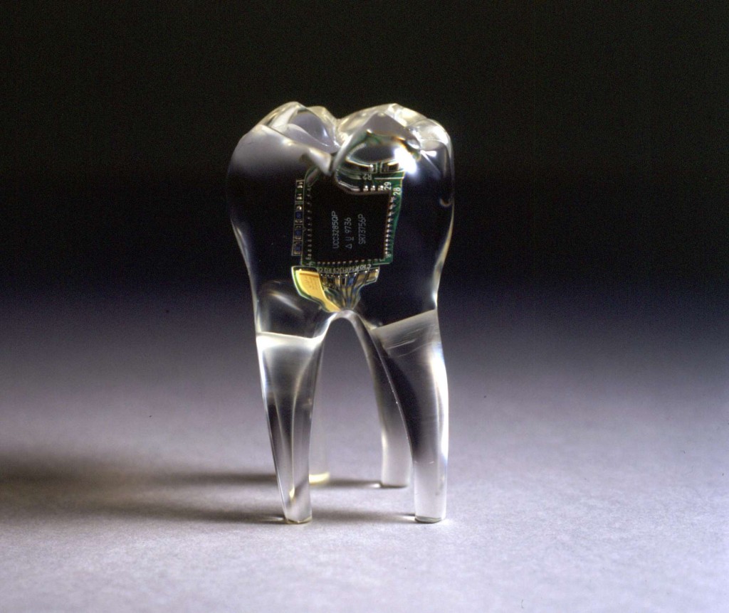 Audio-Tooth-Implant-1024x862