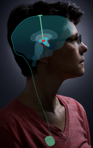 electrified brain