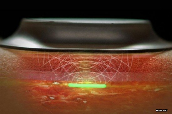 DARPA：投入750萬美元研究可植入生物傳感器