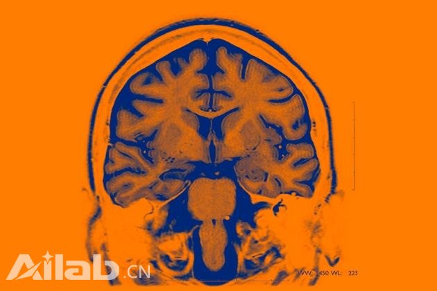最新研究：用AI控制的大腦植入物治療精神疾病